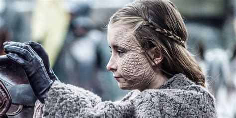 stone sickness game of thrones|Game Of Thrones: Greyscale Explained (& How It Can Be Cured) .